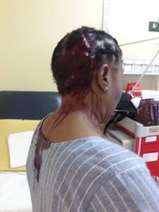 Photos: Teacher lands in hospital after being savagely attacked by pregnant parent