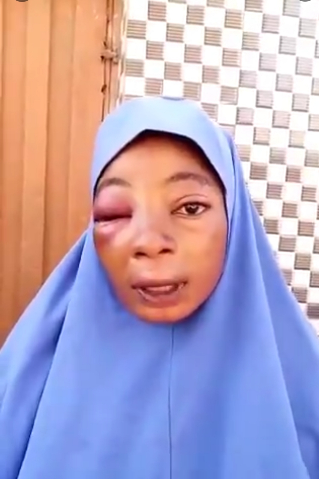 Police Officer Batters Wife Beyond Recognition Over N500