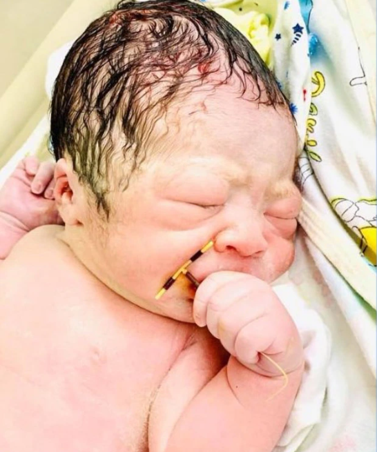 Newborn makes triumphant entry into the world with Mother's contraceptive coil in his hand